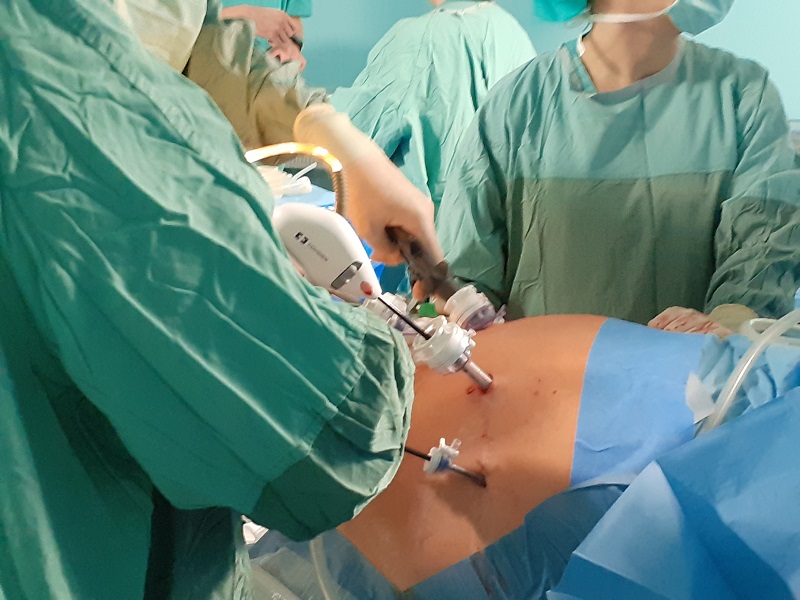 Operacje Bariatryczne W Mazowieckim Szpitalu Specjalistycznym W Radomiu 1233