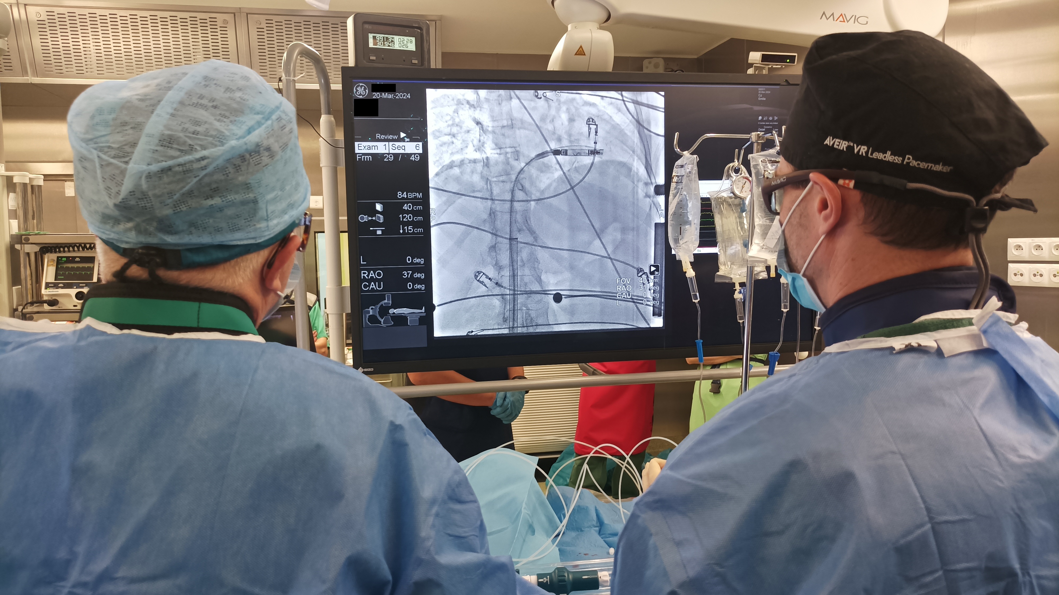 Pierwsza na południu Mazowsza implantacja stymulatora serca bezelektrodowego – nowa metoda terapii dla trudnej grupy pacjentów 
